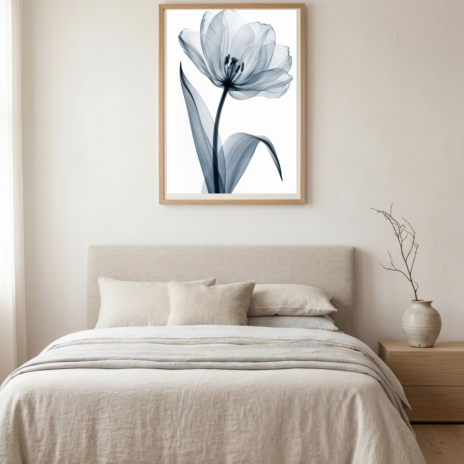Garden Tulip X-Ray Botanical Art Print | Tulipa gesneriana | Scientific Floral Wall Art