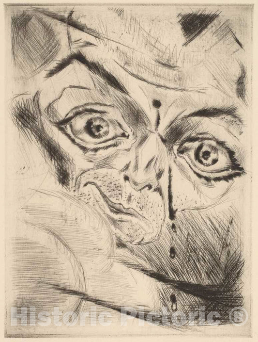 Art Print : Walter GramattÃ©, Peter with a Gunshot Wound in His Forehead, 1918 - Vintage Wall Art