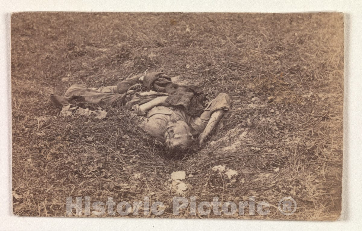 Art Print : Alexander Gardner - Confederate Soldier on The Battlefield at Antietam : Vintage Wall Art