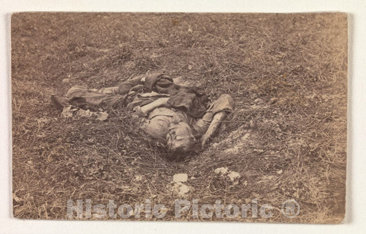 Art Print : Alexander Gardner - Confederate Soldier on The Battlefield at Antietam : Vintage Wall Art