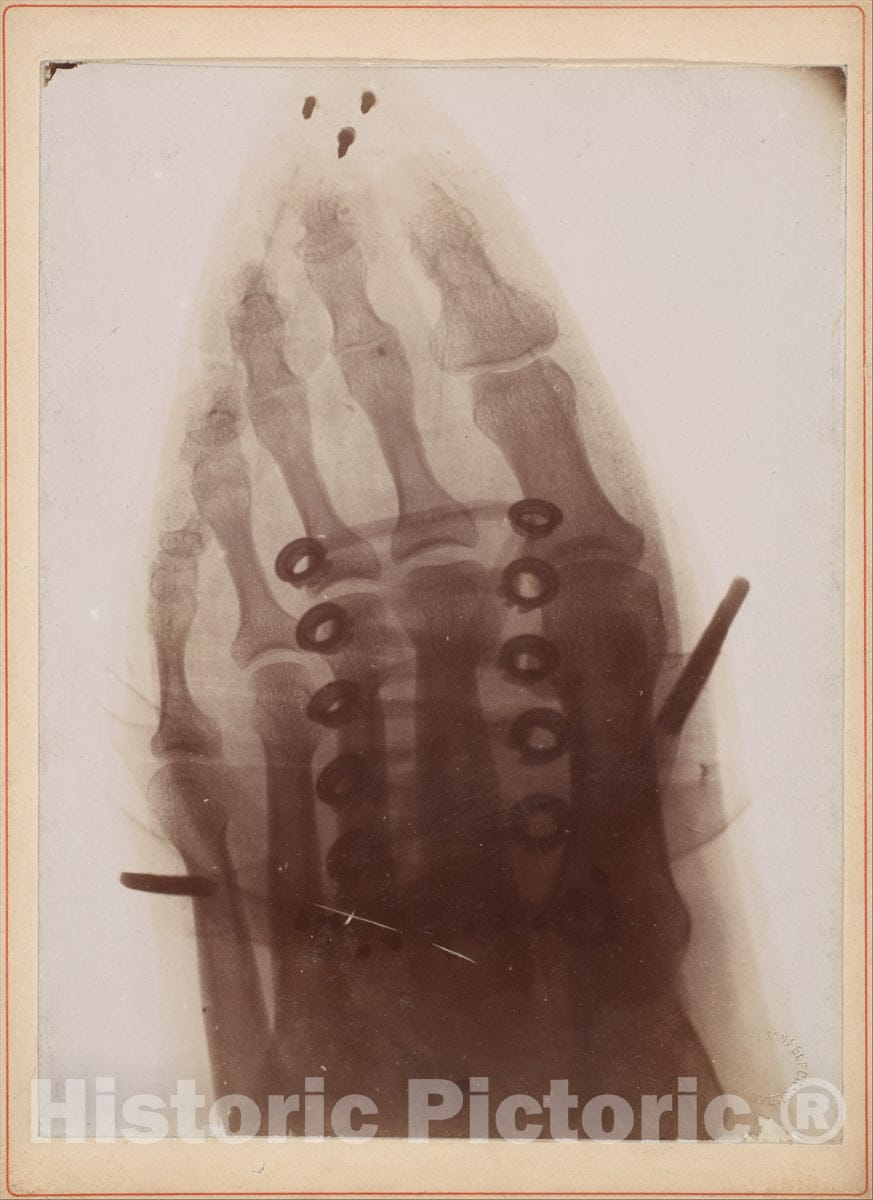 Art Print : Dr. Henri Van Heurck - Le pied à Travers la Chaussure : Vintage Wall Art