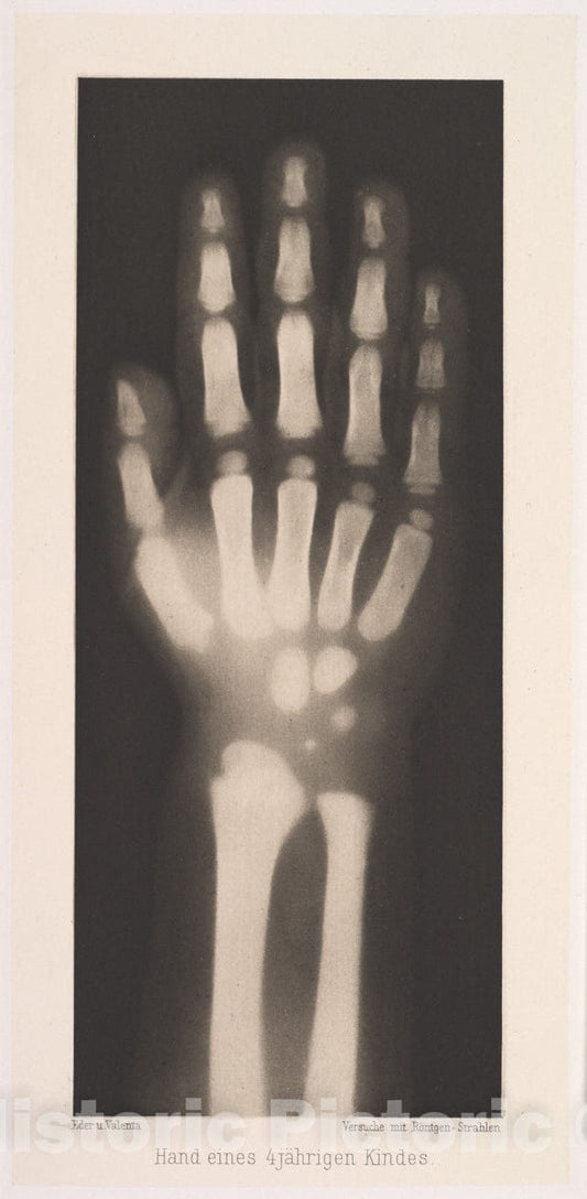 Art Print : Josef Maria Eder - Hand eines 4 jährigen Kindes : Vintage Wall Art