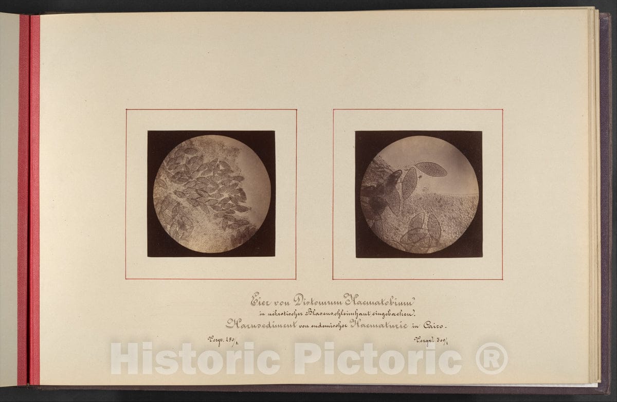 Photo Print : Robert Ultzmann - Mikroskopisch-Photographischer Atlas der Harnsedimente : Vintage Wall Art