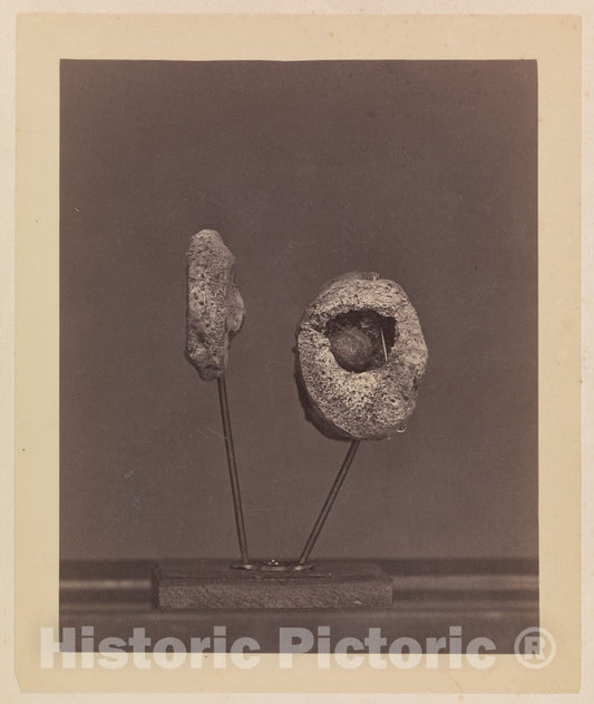 Photo Print : Excised Knee Joint. A Round Musket Ball in The Inner Condyle of The Right Femur Gardiner Lewis - Artist: William Bell - Created: 1866–67 : Vintage Wall Art