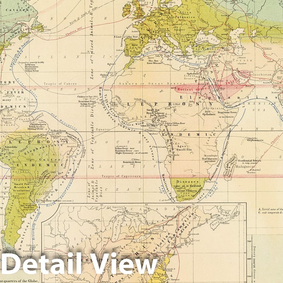 Health and Disease Distribution - United States and West Indies, 1856 - Historical Map Print